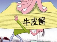 牛皮癣该怎么护理比较好