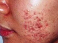 珠海哪家医院皮肤病看的比较好