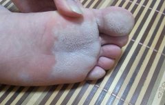 珠海治疗脚气好的专科