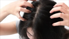 女性怎么诊断自己是否脱发